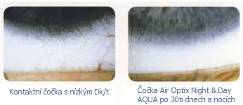 Rozdíl nízké/vysoké Dk/t