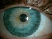 barevná čočka na oku