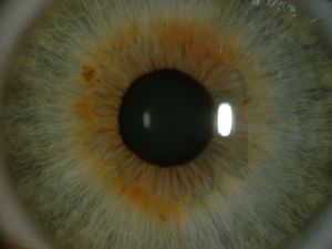 neobvyklá barva duhovky