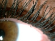 řasy oka s řasenkou